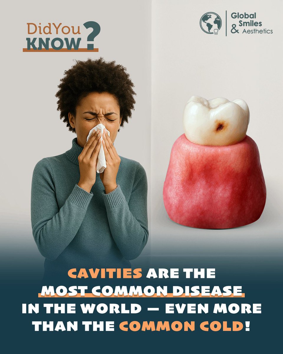 global__smiles's tweet image. 🦷🌍 Did You Know? 😮

Cavities Are the Most Common Disease in the World — Even More Than the Common Cold! 🤧🦷

Stop #ToothDecay with simple habits: brush twice, floss daily, and get #DentalCheckups 🪥.

Protect your teeth and keep your smile strong! 😄

#HealthySmiles