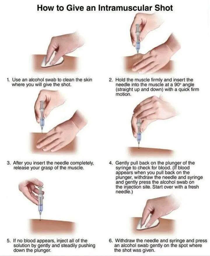 FellowNurses1's tweet image. Intramuscular injection basics – still one of the first skills every nurse perfects.
Save this step-by-step for your next skills check-off or shift!

fellownurses.com