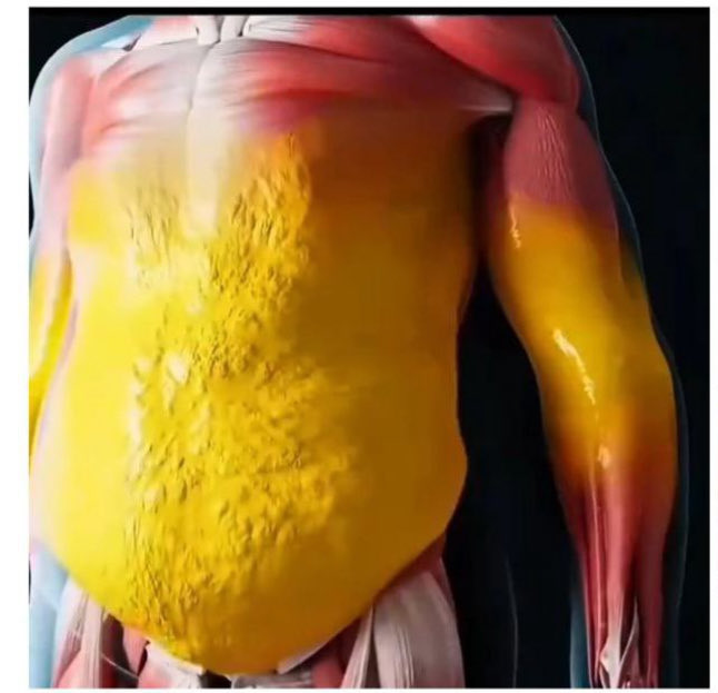 لا يوجد حبوب او عشبة تخلّصك من دهون الكبد وشحوم البطن والكرش؛ الدهون باللون الأصفر 👇🏾سهلة الزوال ١-بالتجويع و٢-الرياضة و٣-المشي اقل شيء٤٠ دقيقة يومياً و٤-تمارين خاصة. ..: 👇🏾وتستطيع التخلص من شحوم الكبد وشحوم البطن والترهل البطني بعدة خطوات وأهمها: 1- قطع الحلويات والمعجنات