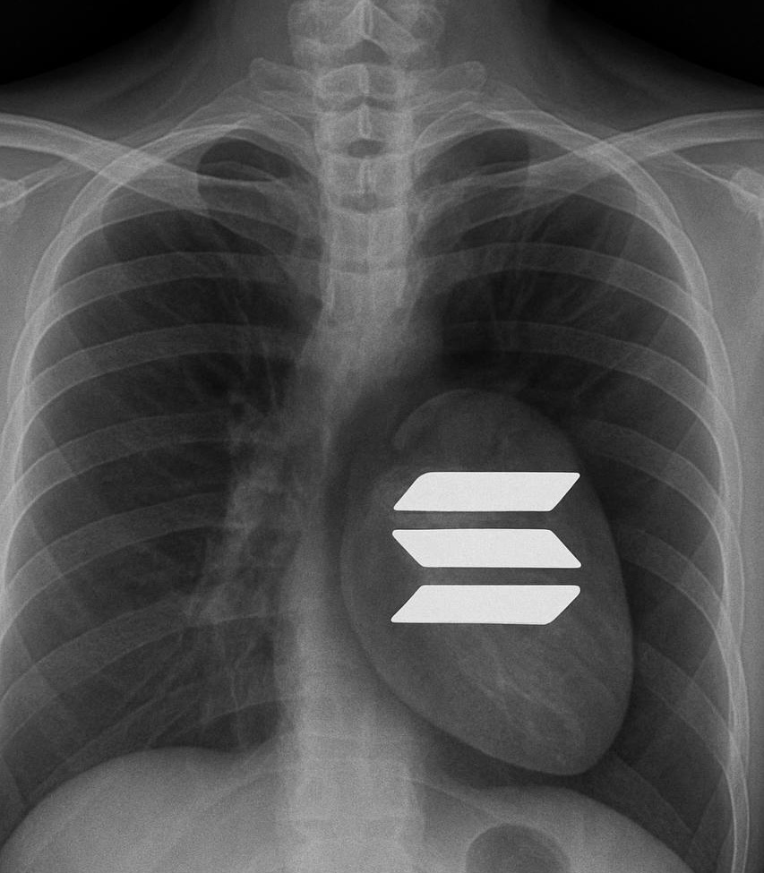 SolanaSensei's tweet image. This appeared on my X-ray results.

The doctor told me it looks healthy.