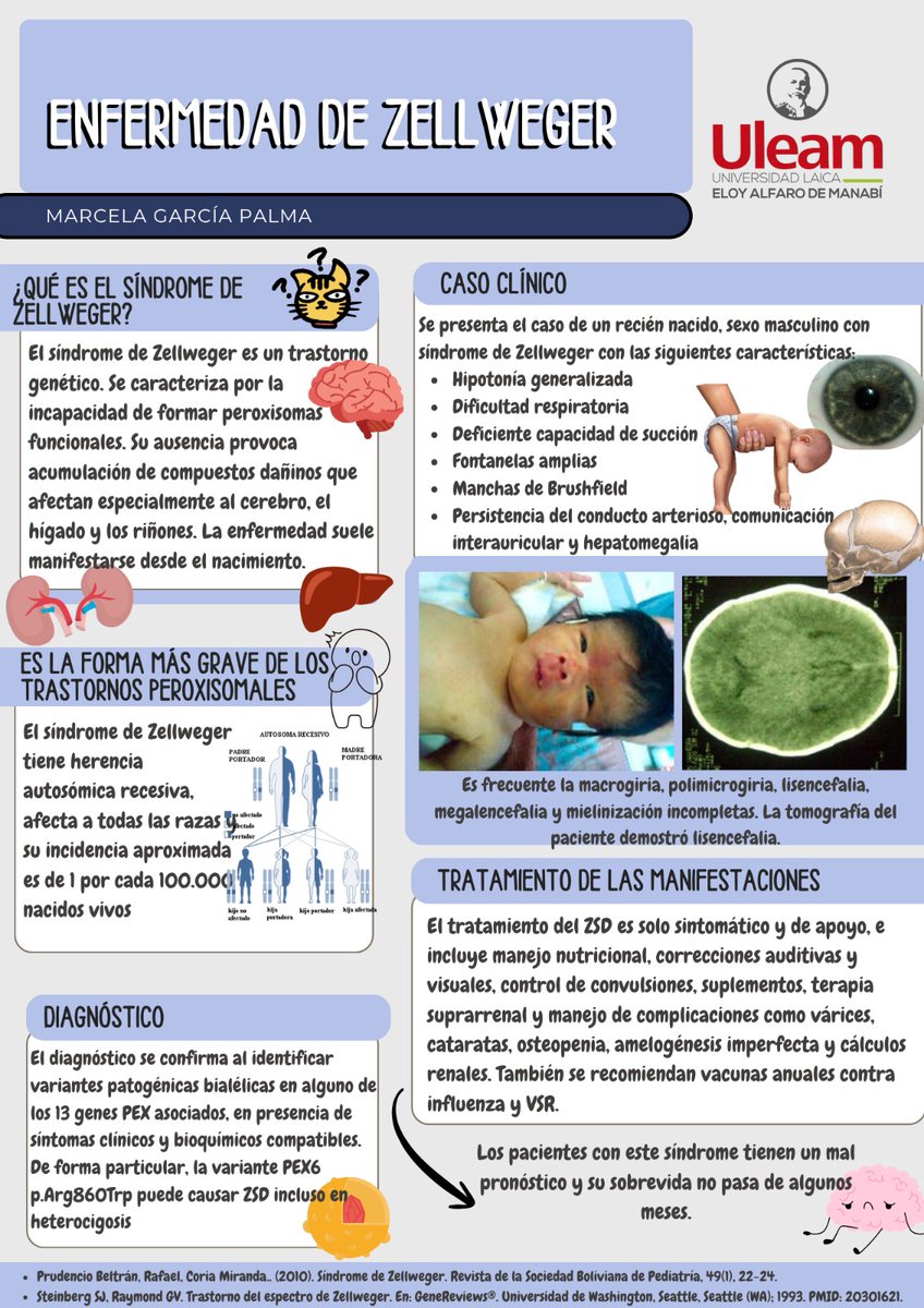 Marce_abbb's tweet photo. ¿Qué sucede cuando el cuerpo no puede formar peroxisomas desde el nacimiento?
Descubre en este post una mirada clara y científica sobre el síndrome de Zellweger 🧠🔬
#Zellweger
#UleamEsAcademia #Uleam40años  @Anghelo77ac @UleamEcuador https://t.co/GooG6aOfFL