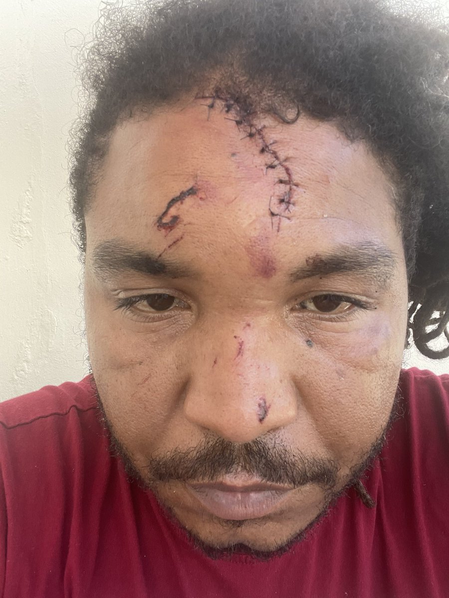 RandyNotNice's tweet image. St thomas got me looking dark but the salt water is helping.