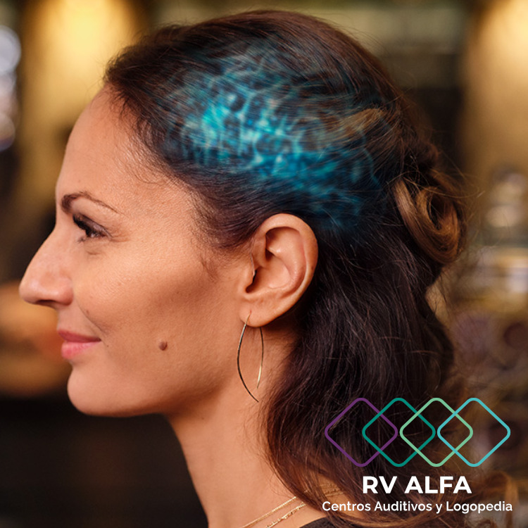 RV ALFA Centros Auditivos tweet media