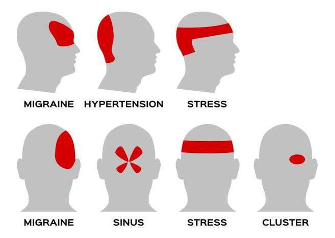 🚩 Headache

Here are the most common physiological triggers:

• Stress raises cortisol and tightens the muscles of the head and neck.
• Dehydration reduces blood volume and increases pain-sensitive signaling.
• Poor sleep disrupts serotonin and pain modulation pathways.
•