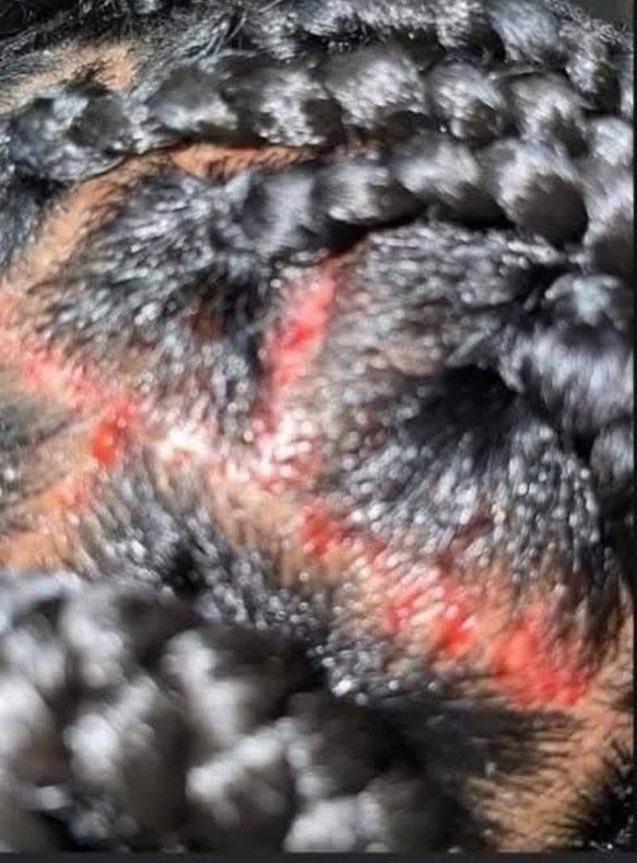 wealth_prettyy's tweet image. The pain women go through just to look good for men, no be for here o😭