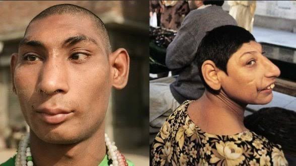 purusa0x6c's tweet image. you ruined your genes. 💔