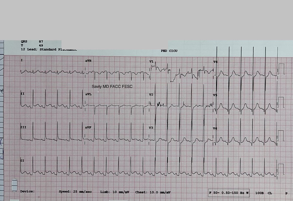 OungSavly's tweet image. 12-year-old boy presents with chest pain in the absence of fever. @jeffrey_vinocur @RobertHPass @iamritu @KaraMotonaga @CASivaram1 @ecgandrhythmRoe @ecgrhythms @SIwa23288585