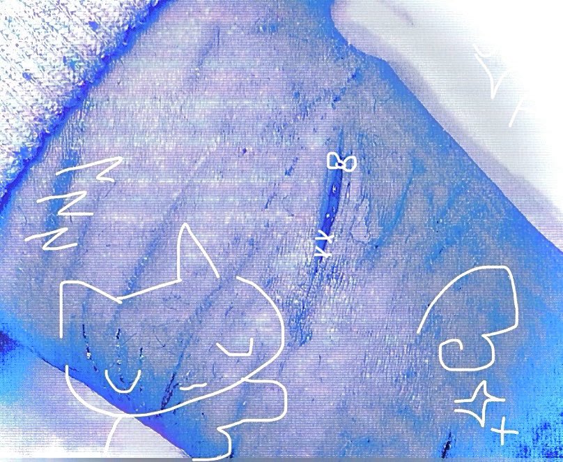 a_x0727's tweet image. #selfharm