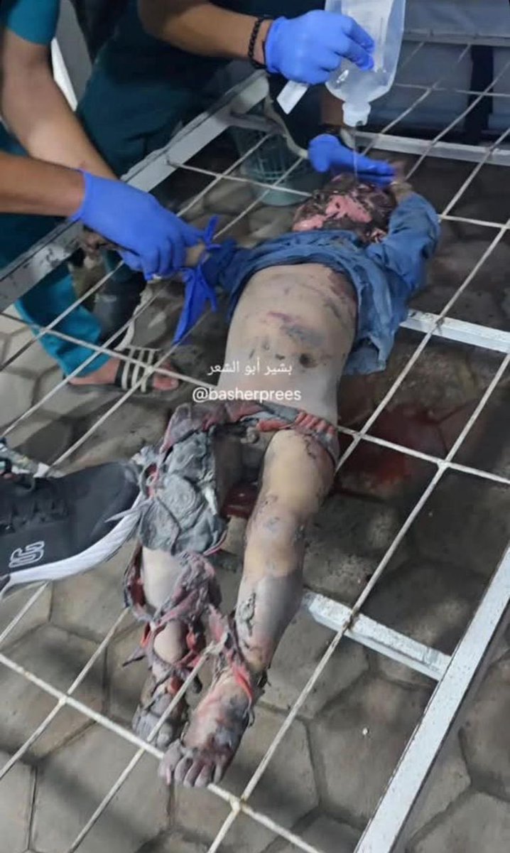 doctor_rahmeh's tweet image. You fund this with our taxes while your wife&apos;s family lives on stolen Palestinian land, you monster.