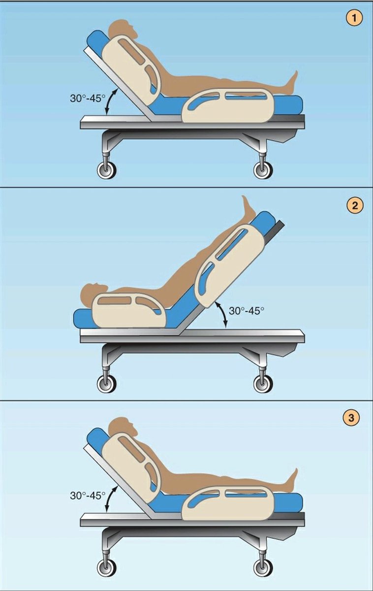 docakx's tweet photo. An ICU patient was made to undergo this.

Why❓️ https://t.co/2Irhmfktsw