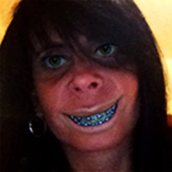 femm_bot_'s tweet image. Aquela amiga com aparelho depois dos 30