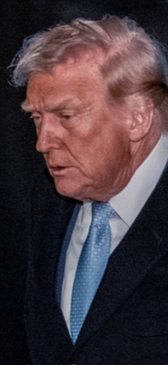 This is not a week man. Look at his face look at his eyes. My mom died from dementia I know that look. He has to be removed immediately