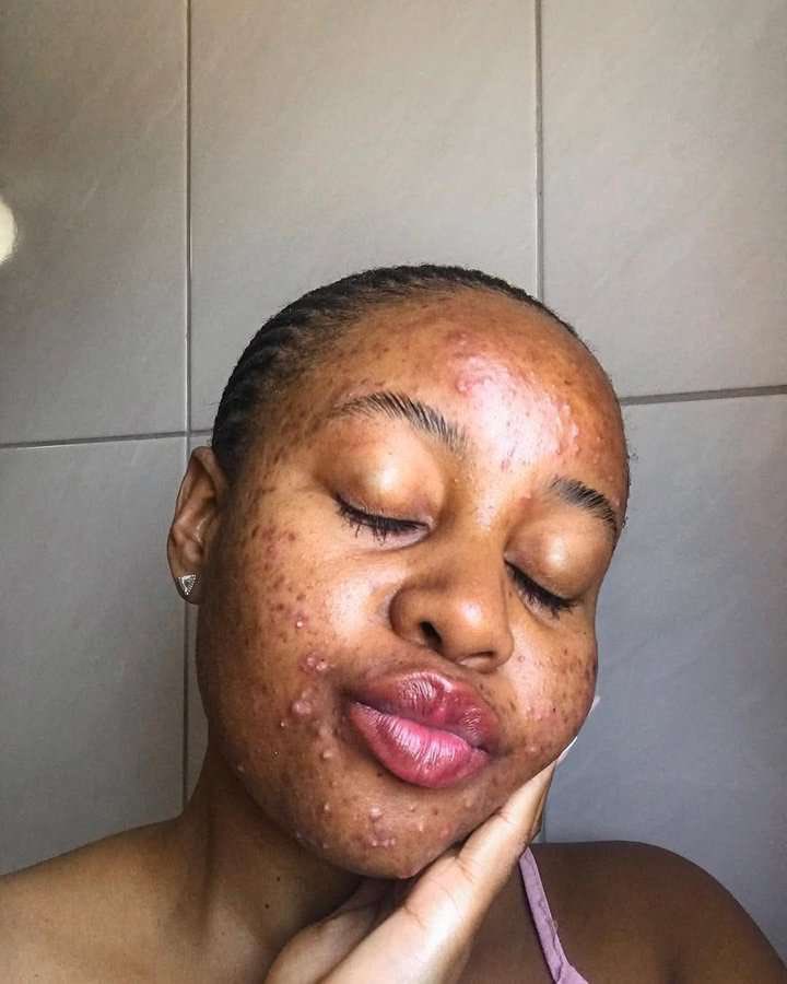 MALAWIAN CHILD🇲🇼 tweet media