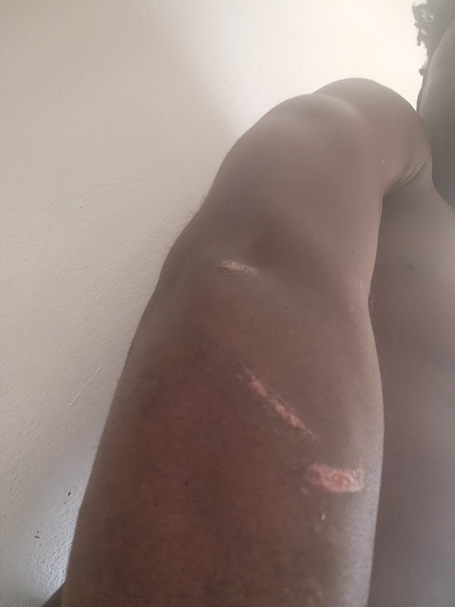 ArnoldUmole's tweet image. I live in Lagos but it didn&apos;t stop me from getting attacked on Sunday last week by robbers and when I reported it, it was the usual, &quot;let us know when you see them again&quot;.
 We&apos;re taking security like a joke in Nigeria, when does it end?
#Nigeria #securityupdate