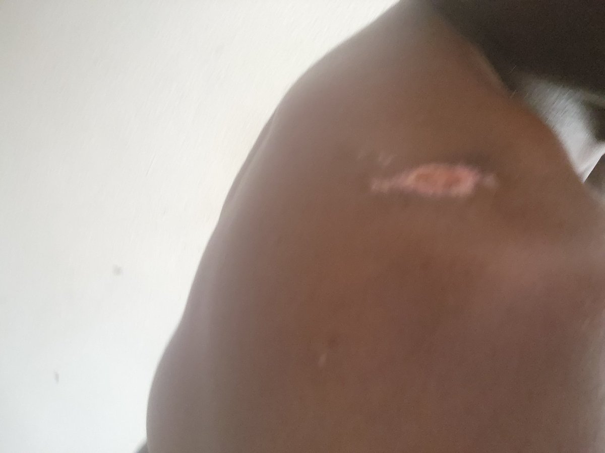 ArnoldUmole's tweet image. I live in Lagos but it didn&apos;t stop me from getting attacked on Sunday last week by robbers and when I reported it, it was the usual, &quot;let us know when you see them again&quot;.
 We&apos;re taking security like a joke in Nigeria, when does it end?
#Nigeria #securityupdate