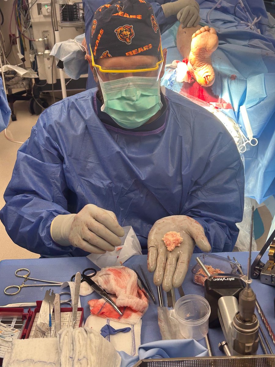 Fusion_Ortho's tweet photo. Dr. Nick Vogelsang, DPM: "Highly effective and efficient... Its ease of use and reliable performance increases my overall confidence in the post-operative healing process."
Biologic solutions built for clinical demands.
#FootAndAnkle #Biologics #OrthopedicSurgery https://t.co/NPeEqEqmft