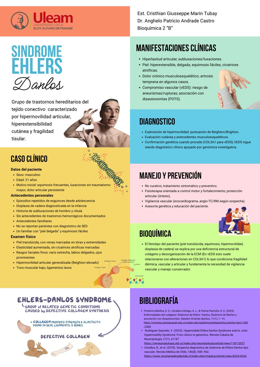 CristhianM26415's tweet photo. ¿Conoce del síndrome de Ehlers-Danlos? ¡Colágeno débil, articulaciones muy flexibles, tejidos frágiles y piel delicada! Origen genético que requiere reconocimiento temprano para un manejo adecuado. #UleamEsAcademia #Uleam40años
@Anghelo77ac @UleamEcuador https://t.co/Fv8IiqOiZd