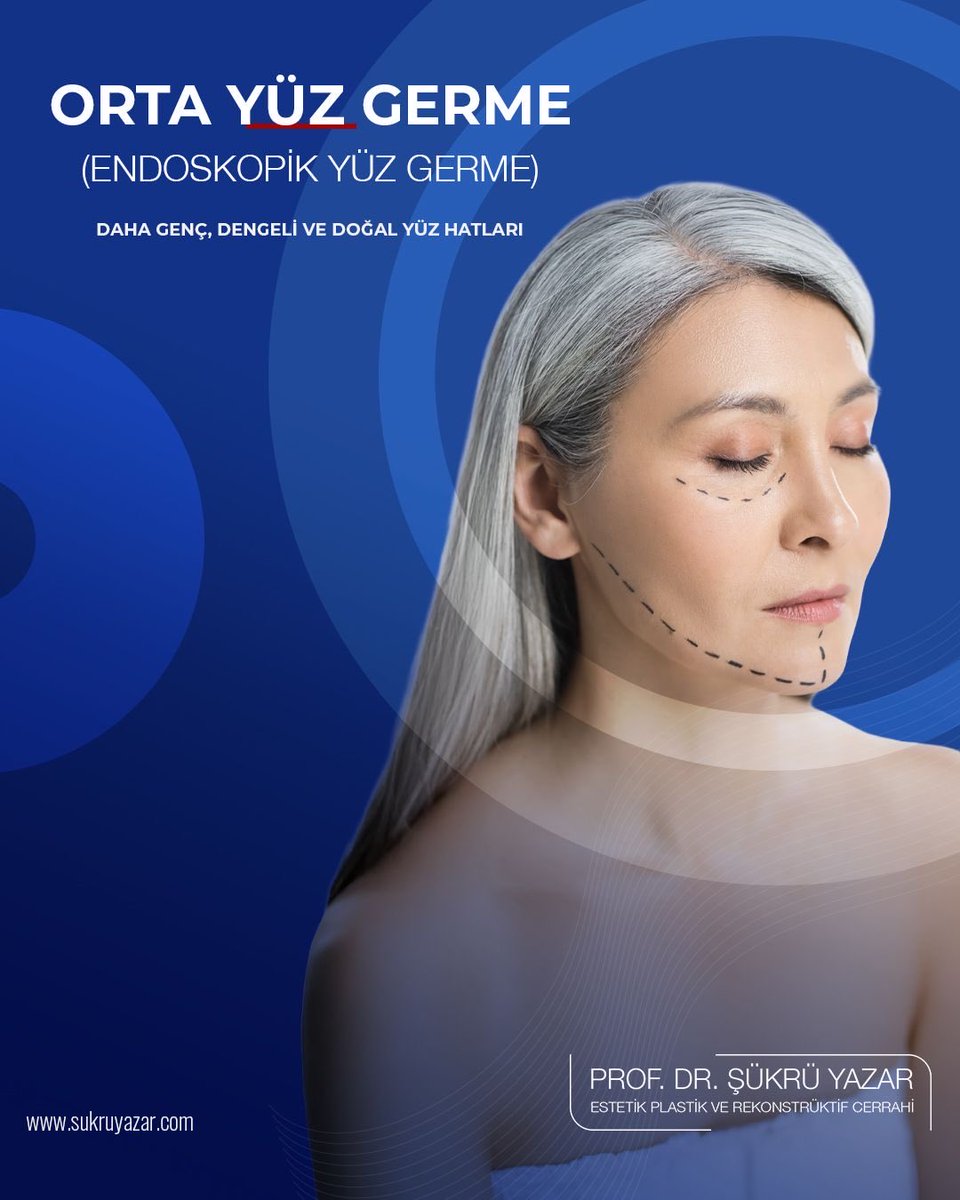 Orta yüz germe (endoskopik yüz germe), göz altındaki sarkan yanak dokularını yukarı taşıyarak daha genç ve dengeli yüz hatları elde etmeyi sağlar.
40–55 yaş aralığında sıkça tercih edilen bu yöntem, doğal sonuçlarıyla öne çıkar.

Randevu ve detaylı bilgi için:
🌐
