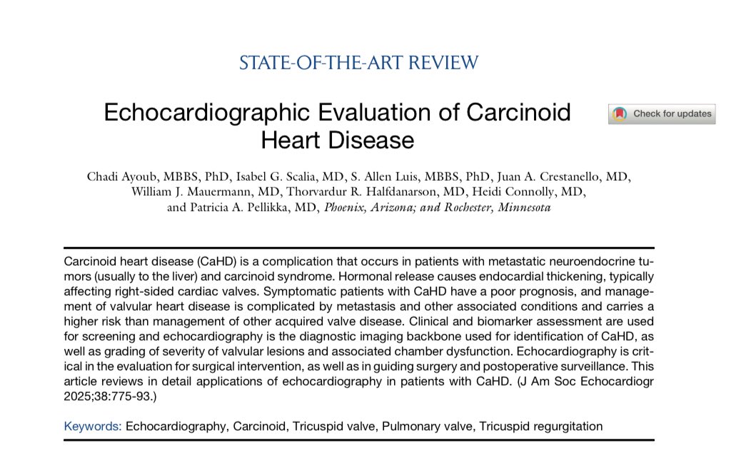 Ed_Alania's tweet image. 🔵 Echocardiographic Evaluation of Carcinoid Heart Disease @JournalASEcho #Cardiology #CardioEd #echofirst #FOAMed