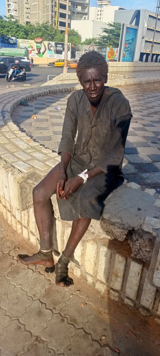 help_clean_mind's tweet image. 🚨 #URGENT   #Il_risque_de_perdre_son_sexe
Un jeune homme est en danger : une élastique etait coincé sur son sexe et l’enflure devient critique.

Nous demandons une prise en charge immédiate.
👉 Merci de taguer @santegouv_sn

La victime : Moussy LY,pikine
Chaque minute compte. 🙏