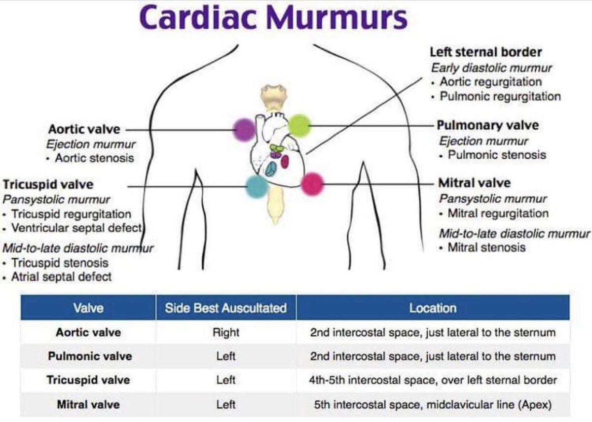 Medical_MD1's tweet image. Great review in murmurs 🤩

.