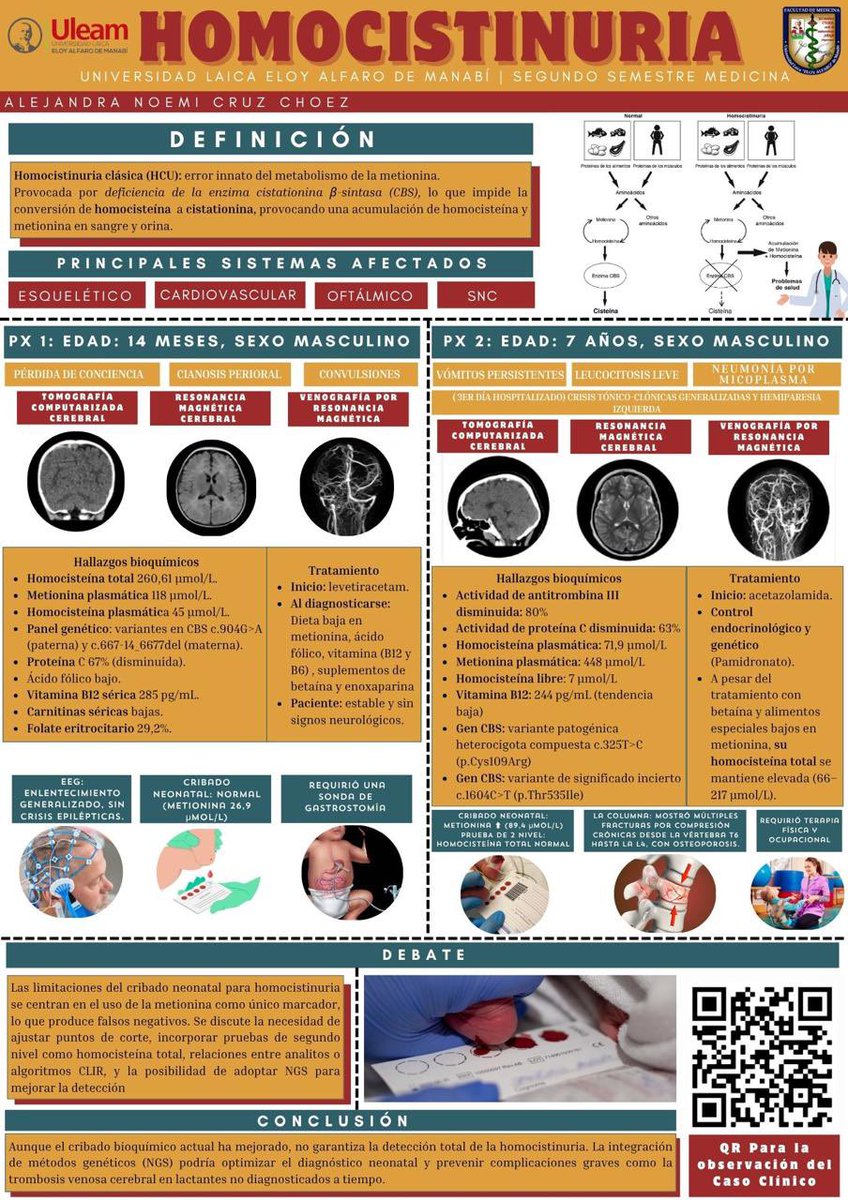 AlejandraC_156's tweet photo. ⚠️¡ATENCIÓN!⚠️
La homocistinuria es una enfermedad que puede afectar el sistema nervioso 🧠, cardiovascular ❤️🩸, esquelético 🦴 y ocular 👀 por déficit de cistationina β-sintasa.
Explore este póster y amplíe su conocimiento📌
#UleamEsAcademia #Uleam40años https://t.co/EMOP0cvSio