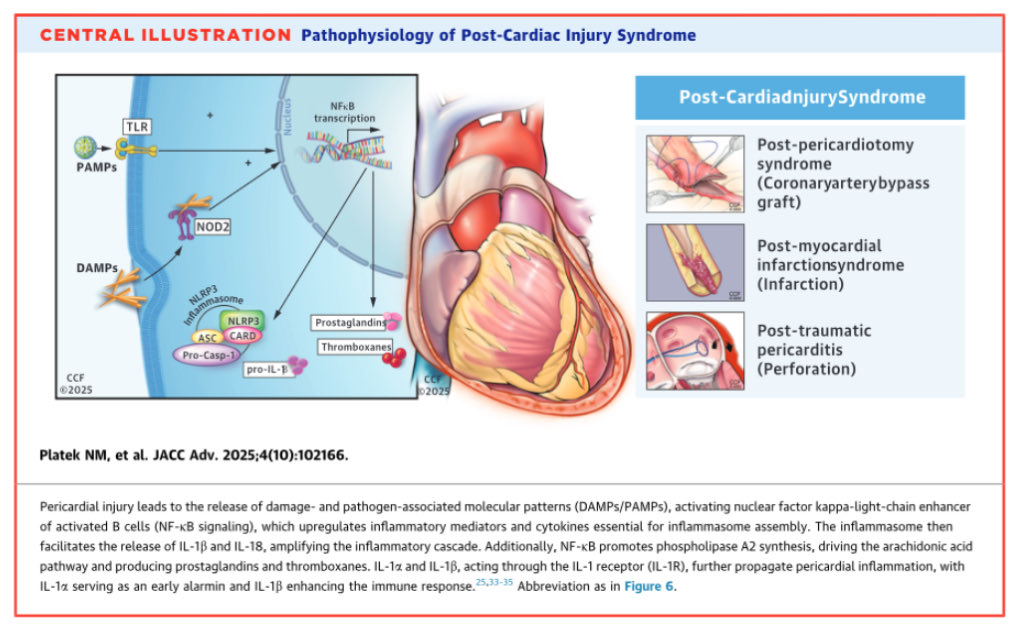 Ed_Alania's tweet photo. 🩸 Post-Cardiac Injury Syndrome: A Paradigm Shift in Diagnosis &amp; Management @JACCJournals #Cardiology #CardioEd #echofirst #Whycmr #FOAMed @MdKhayata @NickPlatekDO https://t.co/ryGVed0f23