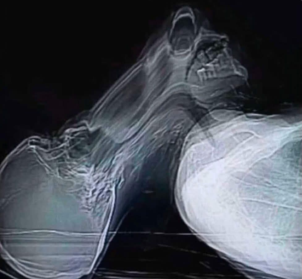 blognaointendo's tweet image. O cara espirrou durante a tomografia computadorizada..