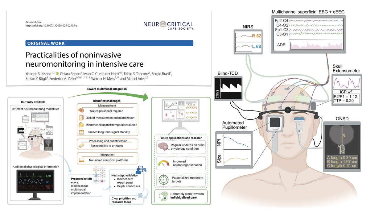 How to use noninvasive neuromonitoring in #ICU? Exploring practical matters/challenges of combining multiple noninvasive neuromonitoring modalities
🖥️  blind-TCD (traditional nonimaging TCD)
🖥️ OSND measurement
⚡️ multichannel continuous EEG
👁️ automated pupillometry
🚨 NIRS
💀