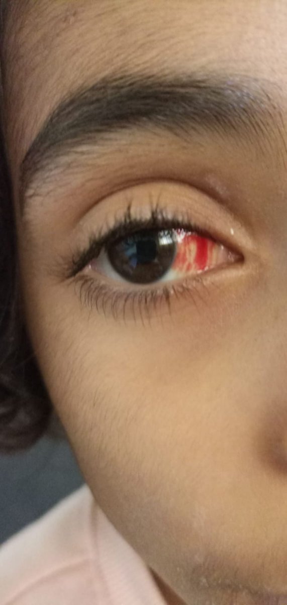 zhal80's tweet image. If no organization intervenes to save her,
we will lose this lil girl to torture.
Save the remaining children of Gaza!