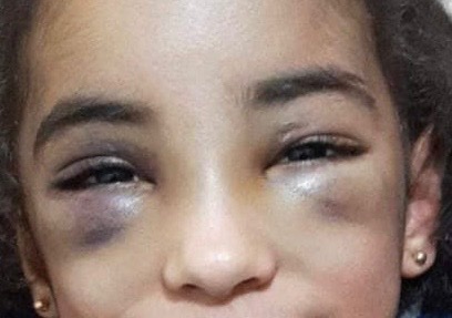 zhal80's tweet image. If no organization intervenes to save her,
we will lose this lil girl to torture.
Save the remaining children of Gaza!