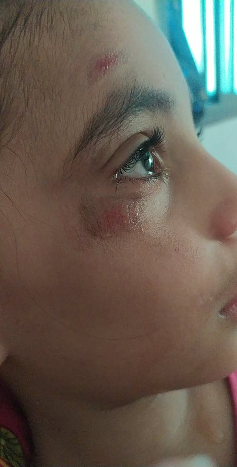 zhal80's tweet image. If no organization intervenes to save her,
we will lose this lil girl to torture.
Save the remaining children of Gaza!