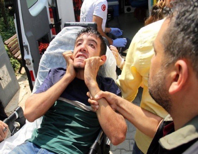 zimbahakan's tweet image. 11. Ayda sivrisinek dolanıyor etrafta