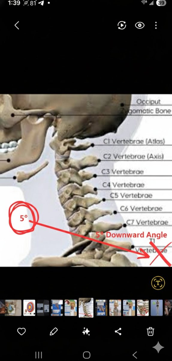 <a href="/BasedSamParker/">Sam Parker 🇺🇸🧯</a> The area of the wound (fact, we all witnessed it) and the reported damage (hearsay) to the c2, c3, c4 and C5 make no sense when we know the downward angle of the shot.