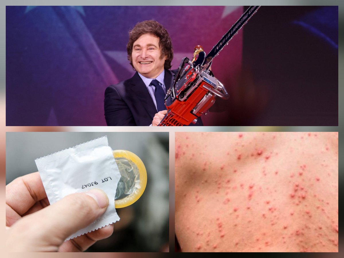 RobertoMerken's tweet image. 🔴 El recorte al presupuesto en prevención sanitaria de Milei ya muestra sus consecuencias: Argentina registra hoy el mayor número de casos de sífilis desde que existen registros oficiales.

🔴 Según el último Boletín Epidemiológico Nacional, los contagios alcanzaron niveles sin…