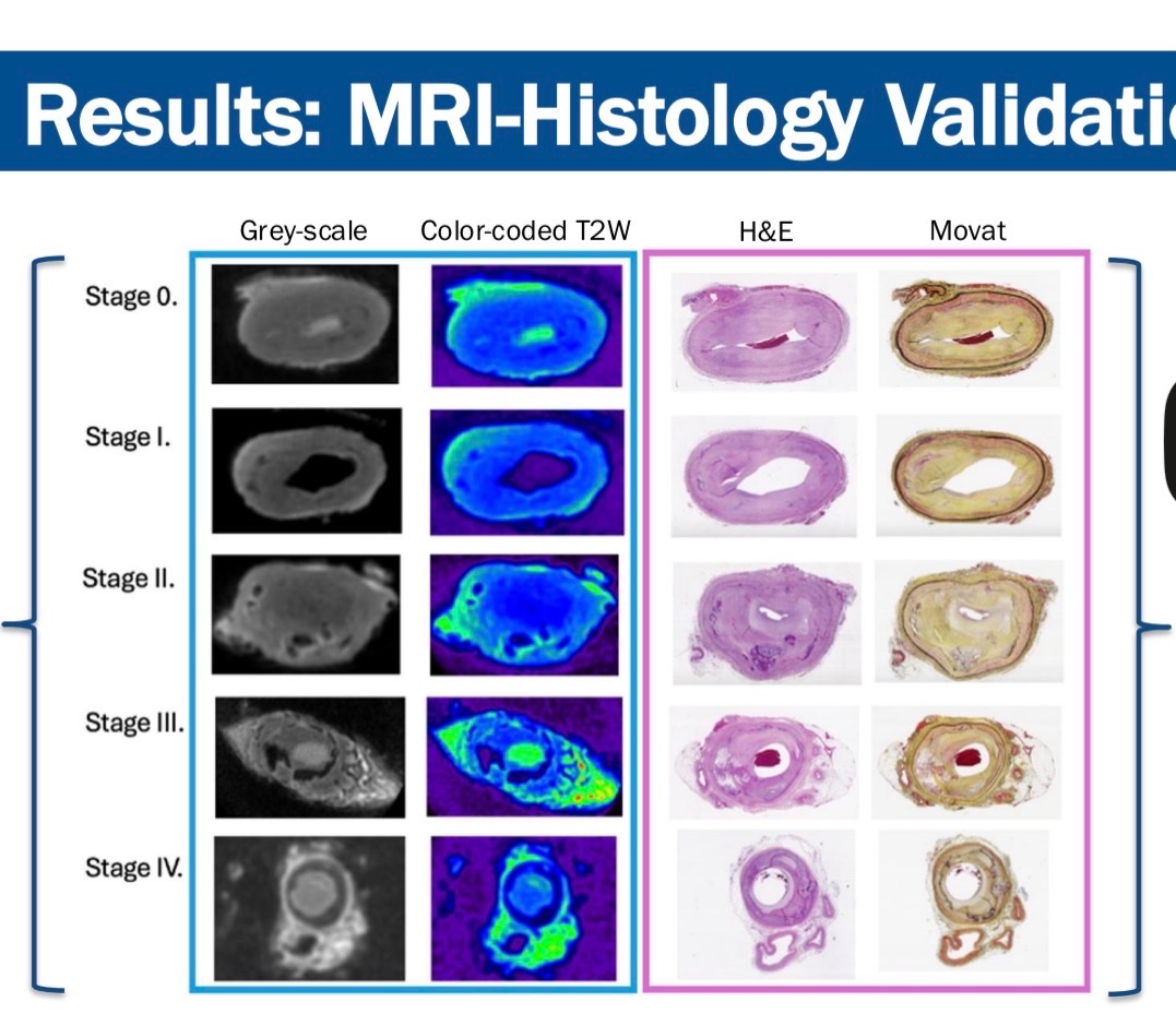 Trisha L. Roy MD PhD FACS tweet media