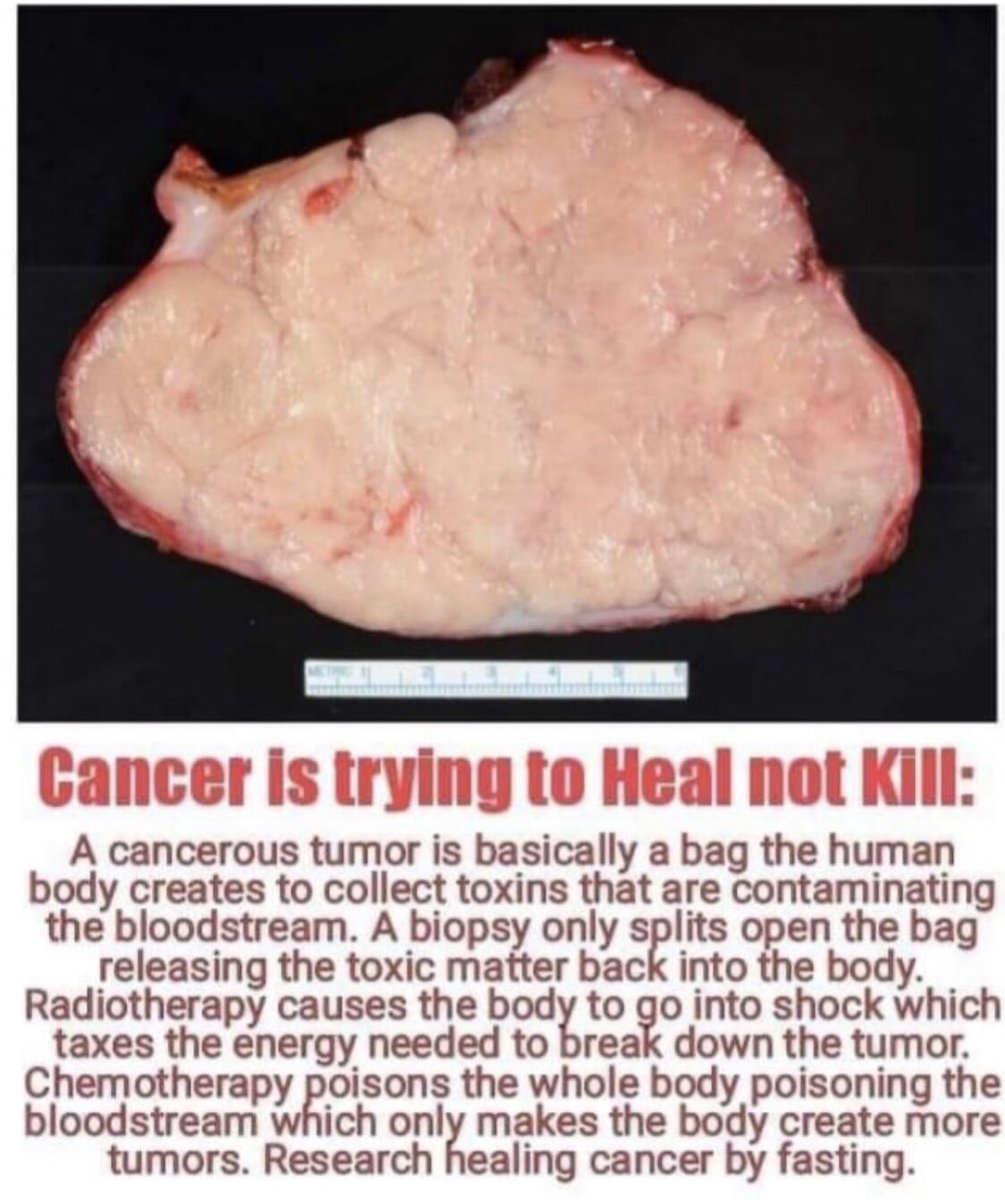 junyongz's tweet image. Fasting cures cancer