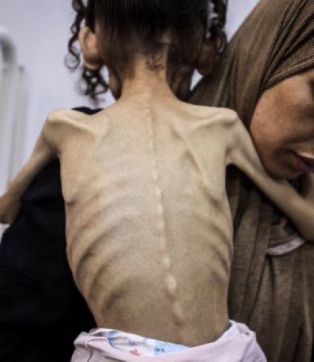 Palestinedaily1's tweet image. If you’re scrolling, PLEASE leave a dot.