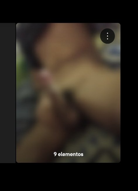 Album x album?