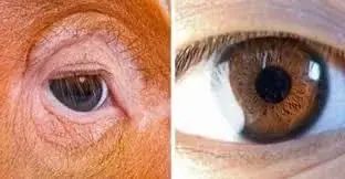 Despite their most recent common ancestor being 100 million years ago, human and pig eyes have such similar structure that they are often used in medical research.