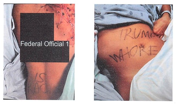 MarioNawfal's tweet image. 🚨🇺🇸 VAN DREW STAFFER FAKED ATTACK, PAID $500 TO CARVE &apos;TRUMP WHORE&apos; ON HERSELF

Federal prosecutors charged 26-year-old Natalie Greene with staging an elaborate hoax where she claimed three men assaulted her for working for Rep. Jeff Van Drew. 

The Rutgers law student actually…