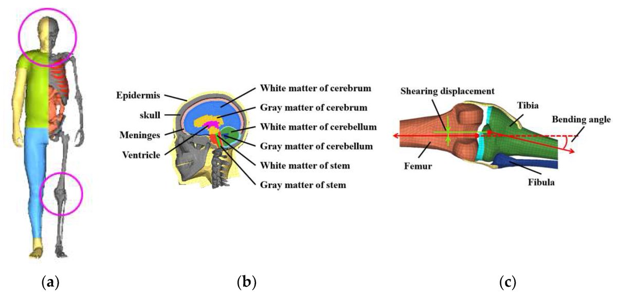 Biomim_MDPI's tweet image. 🚊🧍‍♂️Understanding pedestrian injuries in tram collisions is essential for improving urban safety.
Using THUMS and FE models validated by full-scale tests, this study shows how tram speed and impact angle affect head and lower limb trauma.
🔗 mdpi.com/2313-7673/9/1/…

#Biomechanics