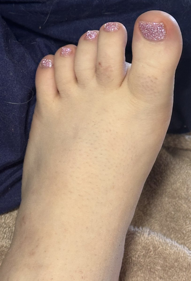 ItsErikabYo's tweet image. The are so dam cute 😍😍
#pedicure #pampertime #metime #crystaljadehairandnails