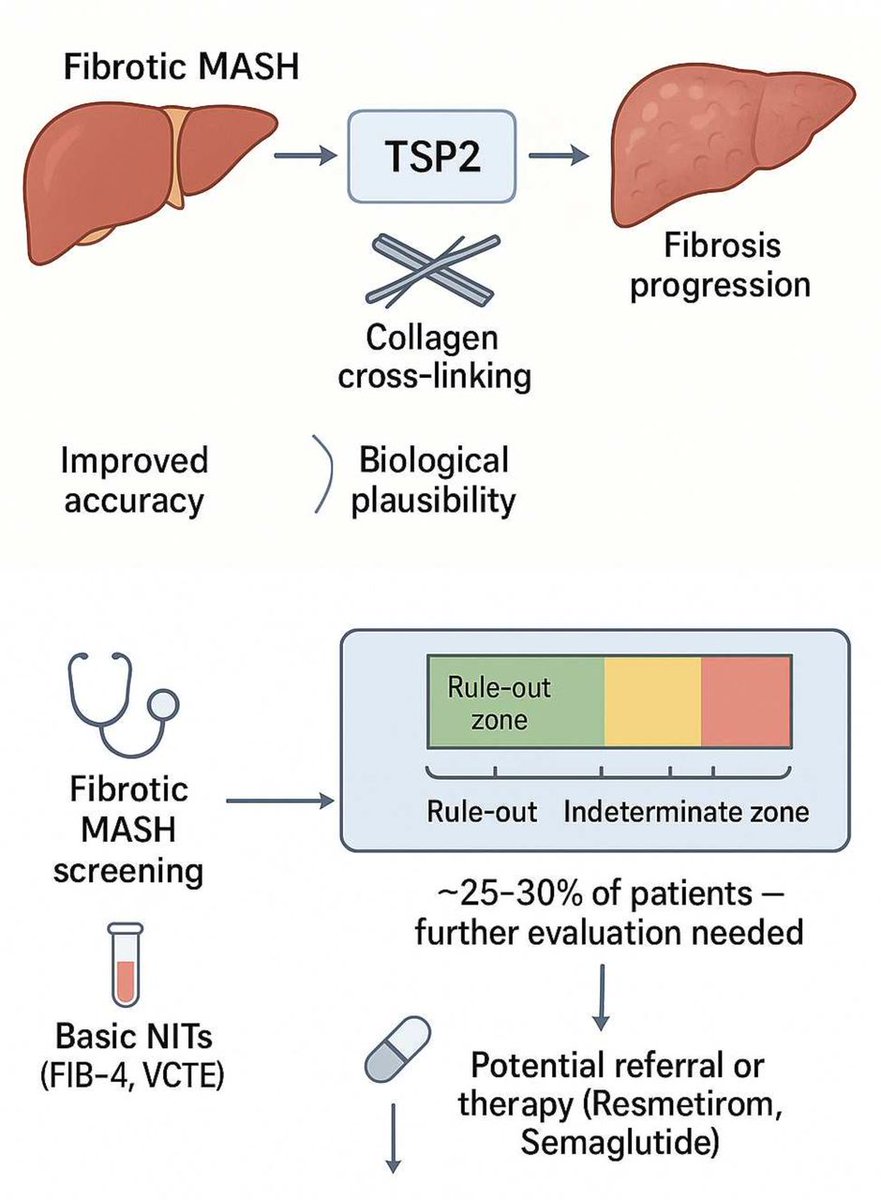 Gut_BMJ's tweet photo. Read the #GUTOnline new #GUTCommentary by Castera et al on
"Thrombospondin-2: a promising but unproven biomarker for MASH" via
https://t.co/FaoZJGc3CU
#MASH https://t.co/NK9Y6YRDpq
