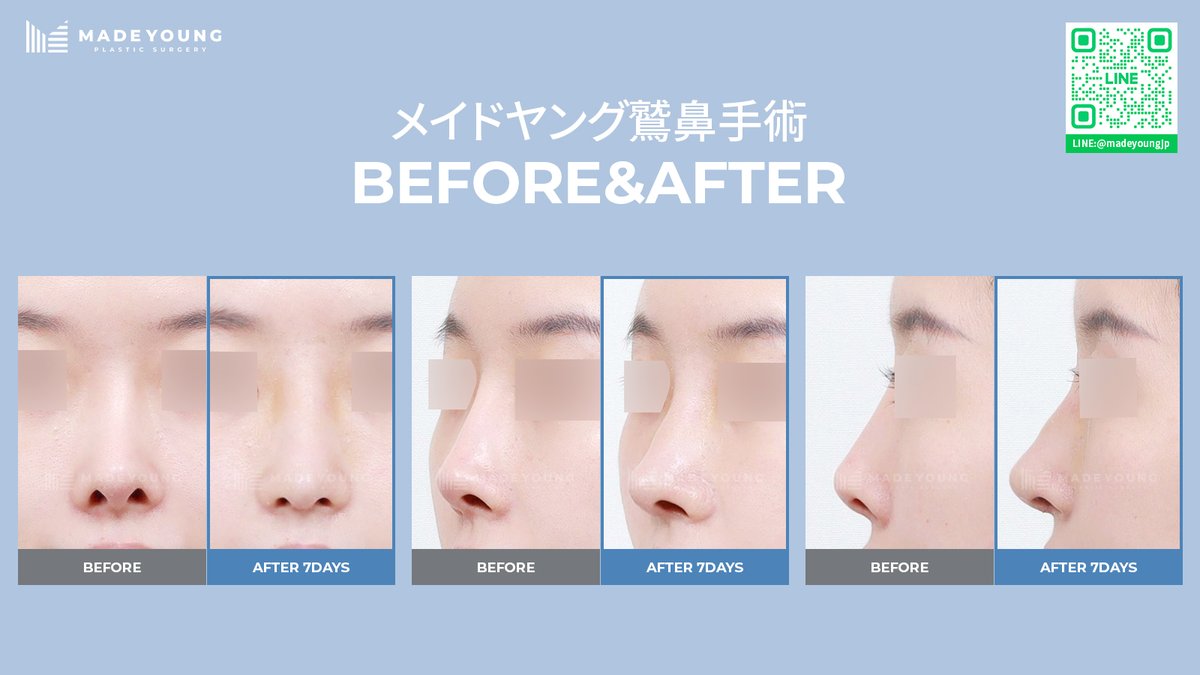 ［公式］メイドヤング美容外科 tweet media