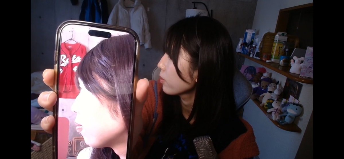 抜歯矯正初めて1年半でこれ！すげー！！！変わってきてる！！！