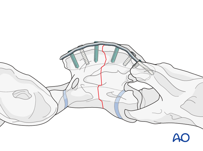 AO Surgery Reference tweet media