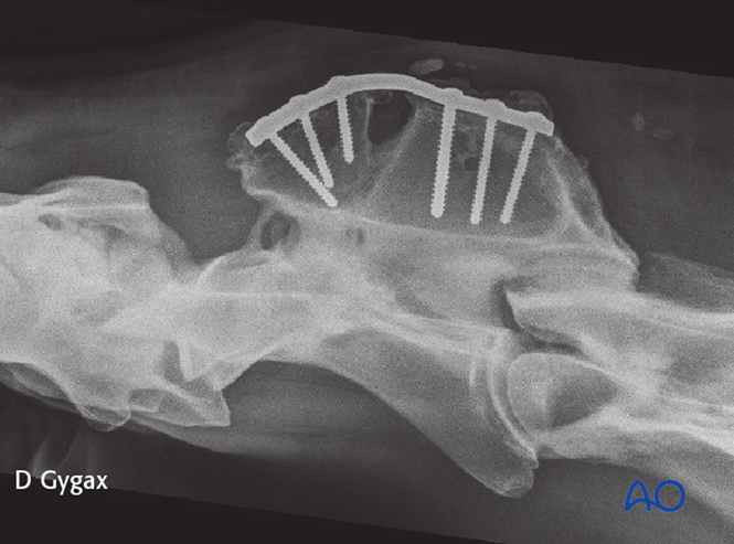 AO Surgery Reference tweet media