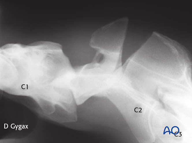 AO Surgery Reference tweet media