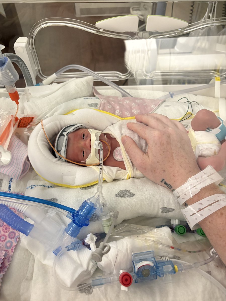goodkarma_mama's tweet photo. Have not been keeping up on Twitter, but Nova Rain was born on 11/16 at 28 weeks 5 days gestation. She weighed only 2lbs 15oz.
Today was her third day in the NICU.
Thank you for following along & your support in our journey. 🖤
#SuperNova #NICUwarrior #NICUbaby #NovaStrong https://t.co/0lSxaTIRvd